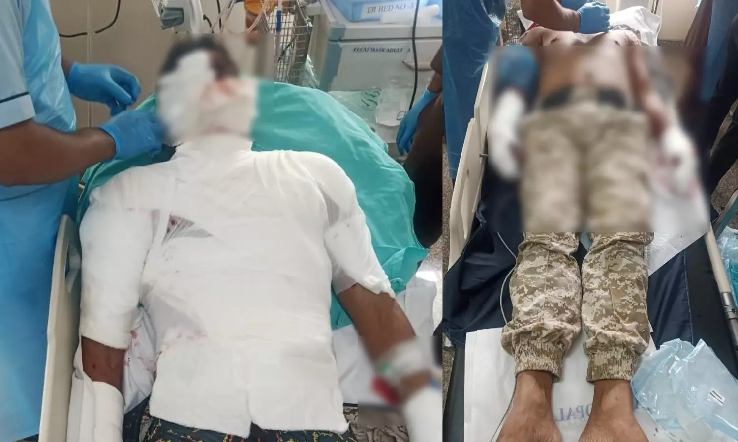 Read more about the article भोपाल की 25वीं बटालियन में मॉक ड्रिल के दौरान बड़ा हादसा: ग्रेनेड ब्लास्ट में दो जवान गंभीर रूप से घायल, एक की हालत नाजुक!