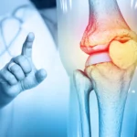 नेशनल बोन एंड जॉइंट्स डे स्पेशल: उम्र बढ़ने के साथ क्यों ज़रूरी है हड्डियों और जोड़ों की देखभाल? जानिए पूरी गाइड